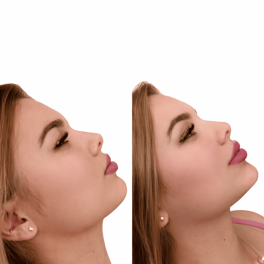 Plump® Volumenizador Labial con Ácido Hialurónico