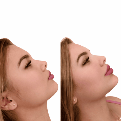 Plump® Volumenizador Labial con Ácido Hialurónico