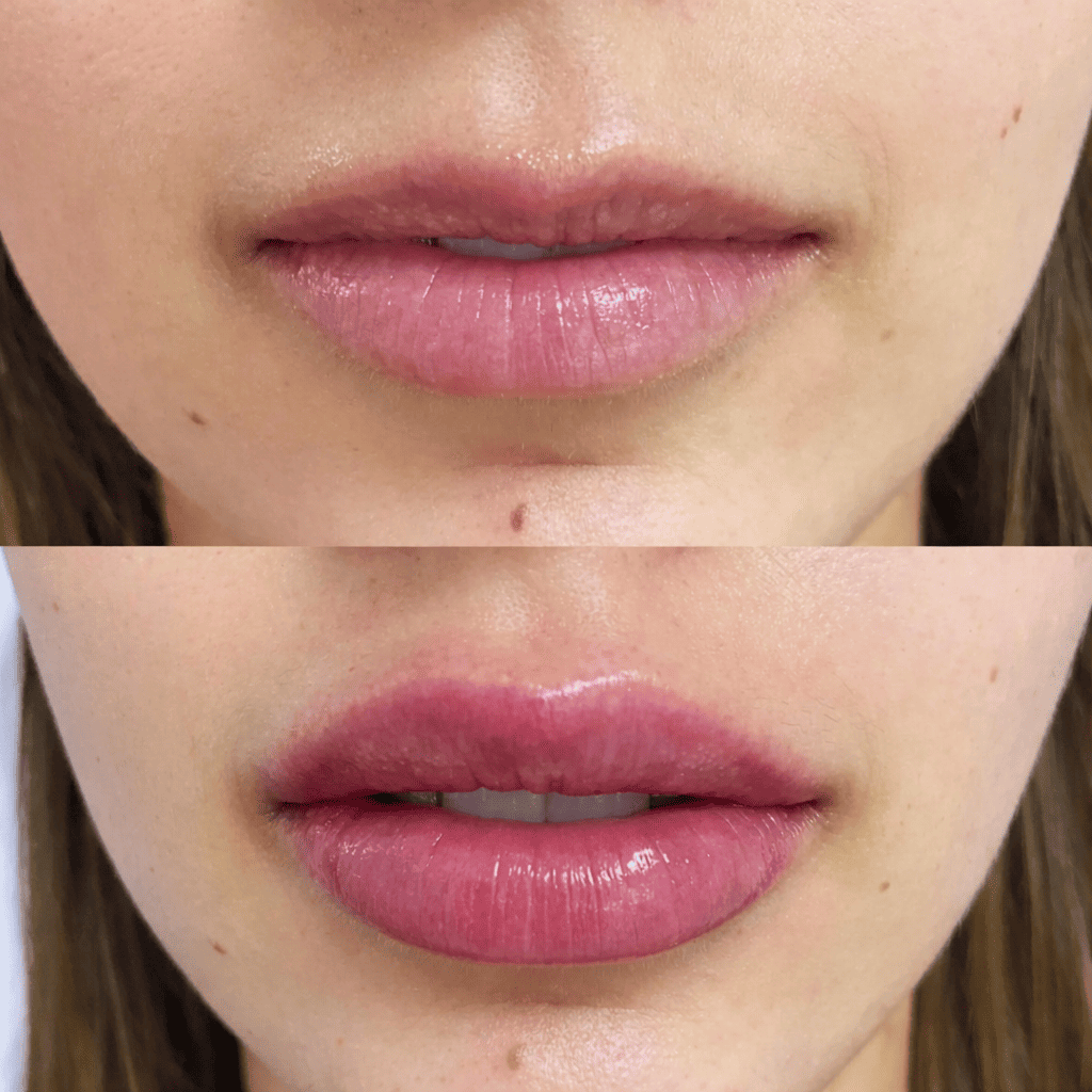 Plump® Volumenizador Labial con Ácido Hialurónico