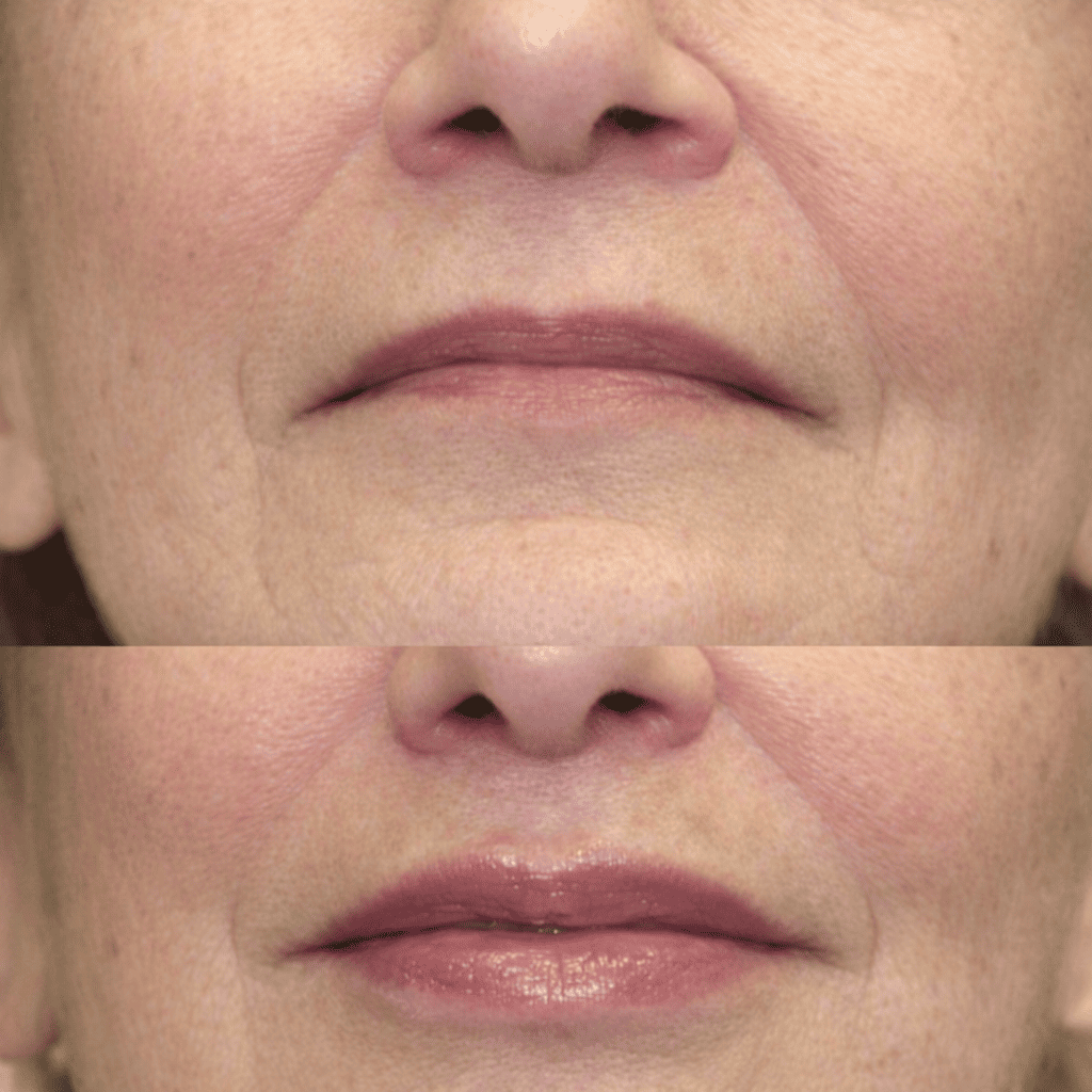 Plump® Volumenizador Labial con Ácido Hialurónico